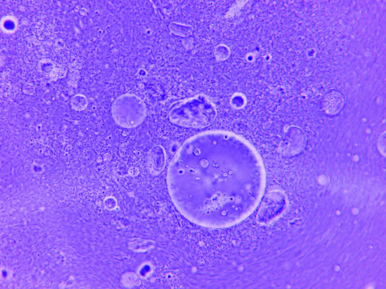 Fluorescent microscopy view of cells stained in blue and violet